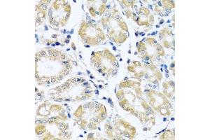 Immunohistochemistry (Paraffin-embedded Sections) (IHC (p)) image for anti-NADH Dehydrogenase (Ubiquinone) 1 beta Subcomplex, 10, 22kDa (NDUFB10) (AA 1-172) antibody (ABIN6144472)