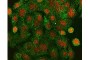 IF analysis of HLTF using anti-HLTF antibody (ABIN4886619) and anti-Tubulin Alpha antibody (ABIN7600339).