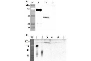 Western blot analysis of human DLK1 using anti-DLK1 (human), pAb  at 1: 2,000 dilution. (DLK1 抗体  (Extracellular Domain))