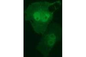Anti-RIT2 mouse monoclonal antibody (ABIN2453598) immunofluorescent staining of COS7 cells transiently transfected by pCMV6-ENTRY RIT2 (RC205367). (RIT2 抗体)