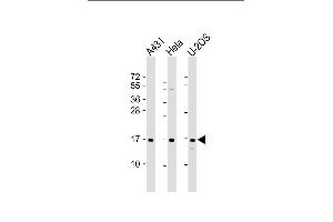 All lanes : Anti-RPLP1 Antibody (N-Term) at 1:2000 dilution Lane 1: A431 whole cell lysate Lane 2: Hela whole cell lysate Lane 3: U-2OS whole cell lysate Lysates/proteins at 20 μg per lane. (RPLP1 抗体  (AA 18-49))