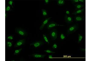 Immunofluorescence of monoclonal antibody to SMAD5 on HeLa cell. (SMAD5 抗体  (AA 105-182))