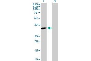 Western Blot analysis of TYMS expression in transfected 293T cell line by TYMS MaxPab polyclonal antibody. (TYMS 抗体  (AA 1-313))
