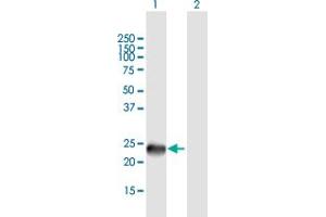 Western Blot analysis of SSX9 expression in transfected 293T cell line by SSX9 MaxPab polyclonal antibody. (SSX9 抗体  (AA 1-188))