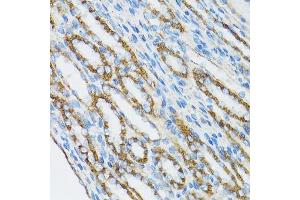 Immunohistochemistry of paraffin-embedded mouse kidney using CTNNA1 antibody. (CTNNA1 抗体  (AA 637-906))