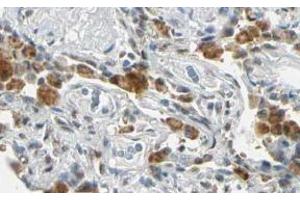 Image no. 2 for anti-Fanconi Anemia Complementation Group G (FANCG) (AA 1-12), (N-Term) antibody (ABIN401267) (FANCG 抗体  (N-Term))