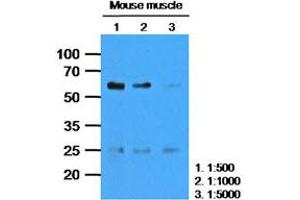 The extracts of Mouse muscle (35ug) were resolved by SDS-PAGE, transferred to PVDF membrane and probed with anti-human CASQ2 (1:1000). (CASQ2 抗体)