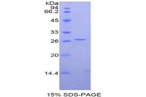 SDS-PAGE analysis of Rat GATA Binding Protein 4 Protein. (GATA4 蛋白)