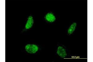 Immunofluorescence of monoclonal antibody to LHX4 on HeLa cell. (LHX4 抗体  (AA 208-306))