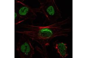 Immunofluorescence analysis of NTERA-2 cells using SIRT1 mouse mAb (green). (SIRT1 抗体)