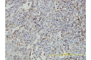Immunoperoxidase of monoclonal antibody to NUCB1 on formalin-fixed paraffin-embedded human spleen tissue. (Nucleobindin 1 抗体  (AA 28-461))
