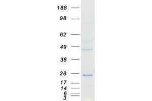 FAM96A Protein (Transcript Variant 1) (Myc-DYKDDDDK Tag)