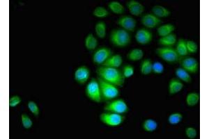 Immunofluorescent analysis of A549 cells using ABIN7143927 at dilution of 1:100 and Alexa Fluor 488-congugated AffiniPure Goat Anti-Rabbit IgG(H+L) (Parvin alpha 抗体  (AA 2-94))