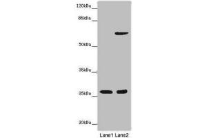 Western blot All lanes: SOX14 antibody at 14 μg/mL Lane 1: Human placenta tissue Lane 2: HepG2 whole cell lysate Secondary Goat polyclonal to rabbit IgG at 1/10000 dilution Predicted band size: 27 kDa Observed band size: 27 kDa (SOX14 抗体  (AA 1-137))