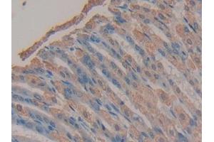 Detection of TMEM27 in Mouse Stomach Tissue using Polyclonal Antibody to Transmembrane Protein 27 (TMEM27) (TMEM27 抗体  (AA 12-222))