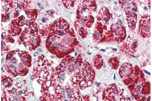 Human Adrenal (formalin-fixed, paraffin-embedded) stained with HSPD1 antibody ABIN462102 at 10 ug/ml followed by biotinylated anti-mouse IgG secondary antibody ABIN481714, alkaline phosphatase-streptavidin and chromogen. (HSPD1 抗体)