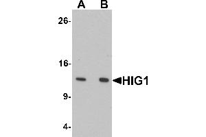 Western blot analysis of HIG1 in 293 cell lysate with HIG1 antibody at at (A) 0. (HIGD1A 抗体  (N-Term))