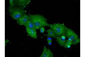 Anti-DPP4 mouse monoclonal antibody (ABIN2452961) immunofluorescent staining of COS7 cells transiently transfected by pCMV6-ENTRY DPP4 (RC209466). (DPP4 抗体)