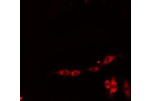 ABIN6278629 staining HepG2 cells by IF/ICC. (RIOK3 抗体  (Internal Region))