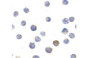 Immunocytochemistry of TSC2 in L1210 cells with this product at 10 μg/ml. (Tuberin 抗体  (N-Term))