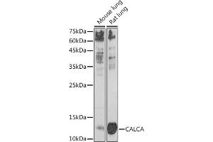 Western blot analysis of extracts of various cell lines, using CALCA antibody (ABIN7266005) at 1:1000 dilution. (CGRP 抗体  (AA 1-141))