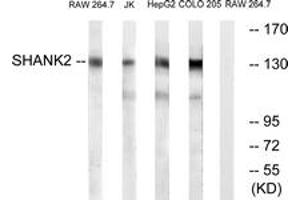 Western blot analysis of extracts from RAW264. (SHANK2 抗体  (AA 331-380))