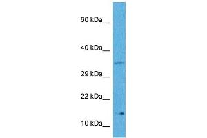 Host:  Rabbit  Target Name:  MYCNOS  Sample Tissue:  Human Hela Whole Cell  Antibody Dilution:  1ug/ml (MYCNOS 抗体  (N-Term))