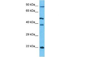 Host:  Rabbit  Target Name:  PCDHB5  Sample Type:  293T Whole Cell lysates  Antibody Dilution:  1. (PCDHb5 抗体  (N-Term))