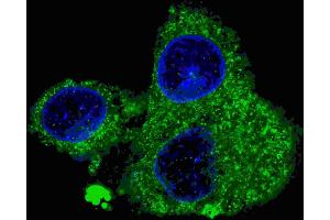 Fluorescent confocal image of HepG2 cells stained with FASN (Center) antibody. (Fatty Acid Synthase 抗体  (AA 942-973))