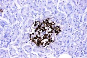 IHC analysis of VIP using anti-VIP antibody (ABIN4886760). (Vip 抗体  (Middle Region))