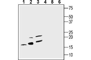 Ionized Calcium-binding Adapter Molecule 1 (IBA1) peptide