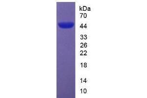 SDS-PAGE analysis of Mouse Apolipoprotein A5 Protein. (APOA5 蛋白)