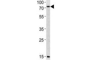 Western blot analysis of lysate from mouse NIH3T3 cell line using PAK3 antibody diluted at 1:1000 for each lane. (PAK3 抗体  (AA 124-152))