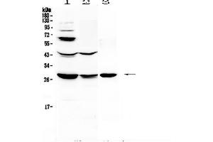 Western blot analysis of TL1A using anti-TL1A antibody .