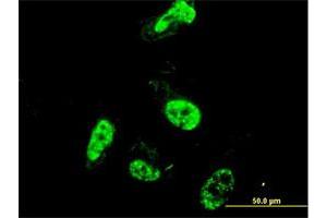 Immunofluorescence of monoclonal antibody to PML on HeLa cell. (PML 抗体  (AA 411-510))