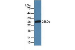 Detection of Recombinant Fibronectin, Gallus using Polyclonal Antibody to Fibronectin (FN) (Fibronectin 抗体  (AA 510-689))