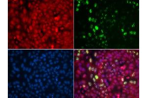 Immunofluorescence analysis of U2OS cells using Phospho-ABL1-Y204 antibody (ABIN5969866). (ABL1 抗体  (pTyr204))