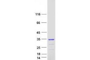 Non-SMC Element 1 Homolog (NSMCE1) protein (Myc-DYKDDDDK Tag)
