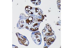 Immunohistochemistry of paraffin-embedded human placenta using Fibrinogen alpha chain (Fibrinogen alpha chain (FGA)) Rabbit pAb (ABIN7267178) at dilution of 1:100 (40x lens). (FGA 抗体  (AA 1-100))