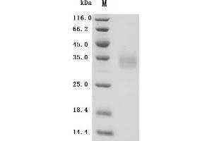 (Tris-Glycine gel) Discontinuous SDS-PAGE (reduced) with 5 % enrichment gel and 15 % separation gel.