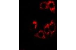 Immunofluorescent analysis of SHP staining in U2OS cells. (NR0B2 抗体)