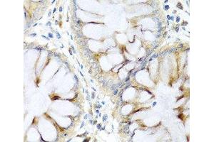 Immunohistochemistry of paraffin-embedded Human colon using PI3 Polyclonal Antibody at dilution of 1:100 (40x lens). (PI3 抗体)