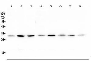 Western blot analysis of RPS3 using anti-RPS3 antibody (ABIN6719371).