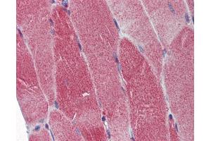 Immunohistochemistry (IHC) image for anti-Polymerase (DNA Directed), gamma (POLG) (C-Term) antibody (ABIN2854742)