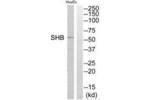 Western blot analysis of extracts from HuvEc cells, using SHB antibody. (SHB 抗体  (C-Term))