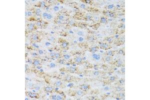 Immunohistochemistry of paraffin-embedded mouse liver using TIRAP antibody. (TIRAP 抗体  (AA 1-221))