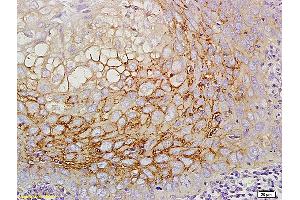 Formalin-fixed and paraffin embedded mouse intestine labeled with Anti CD44v5 Polyclonal Antibody, Unconjugated (ABIN680623) at 1:200 followed by conjugation to the secondary antibody and DAB staining (CD44RC (AA 61-139) 抗体)