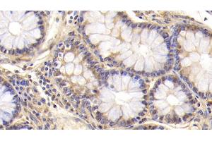 Detection of CD3e in Human Colon Tissue using Polyclonal Antibody to T-Cell Surface Glycoprotein CD3 Epsilon (CD3e)