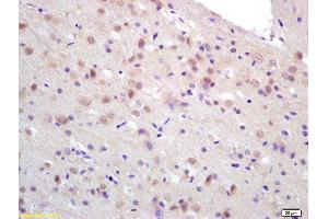 Formalin-fixed and paraffin embedded rat brain labeled with Rabbit Anti CCDC12 Polyclonal Antibody, Unconjugated (ABIN872486) at 1:200 followed by conjugation to the secondary antibody and DAB staining (CCDC12 抗体  (AA 19-120))