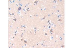 Used in DAB staining on fromalin fixed paraffin- embedded Kidney tissue (CA8 抗体  (AA 1-290))